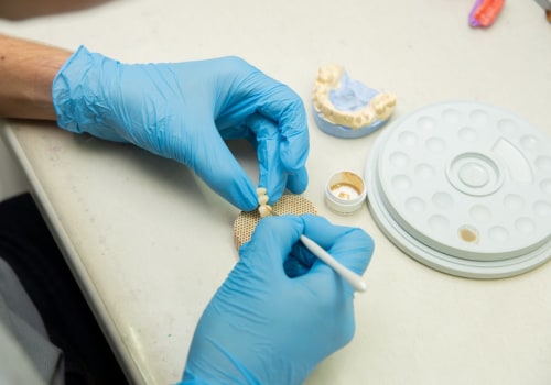 Regain Your Smile: Exploring Dental Implants In North Kansas City